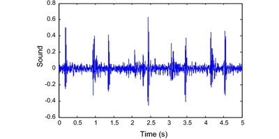 Звук удара сердца