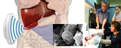 Лабораторный эксперимент по ультразвуковой хирургии с помощью мощного фокусированного ультразвука